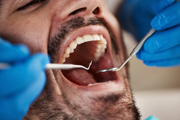 Best Emergency Broken Tooth Repair in Centralia, WA